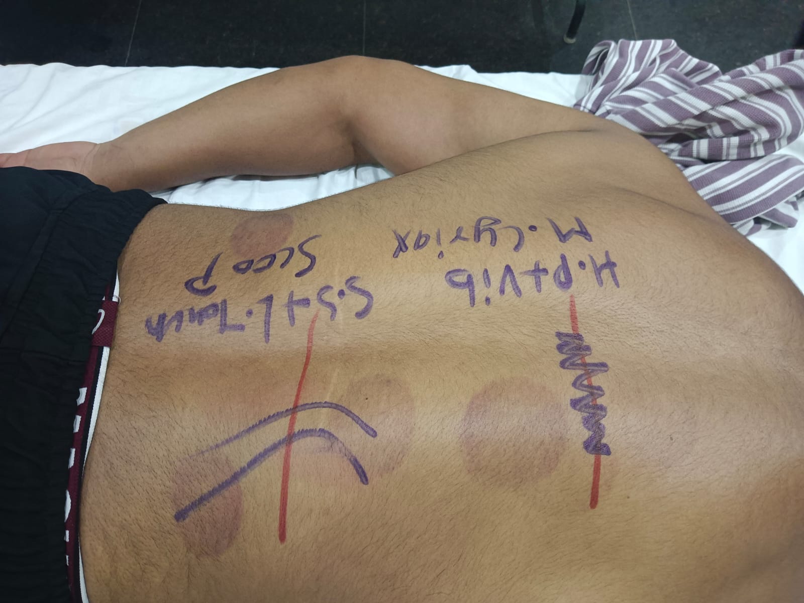Rehabilitation exercises during adult therapy